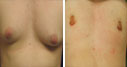 Before & After Photos